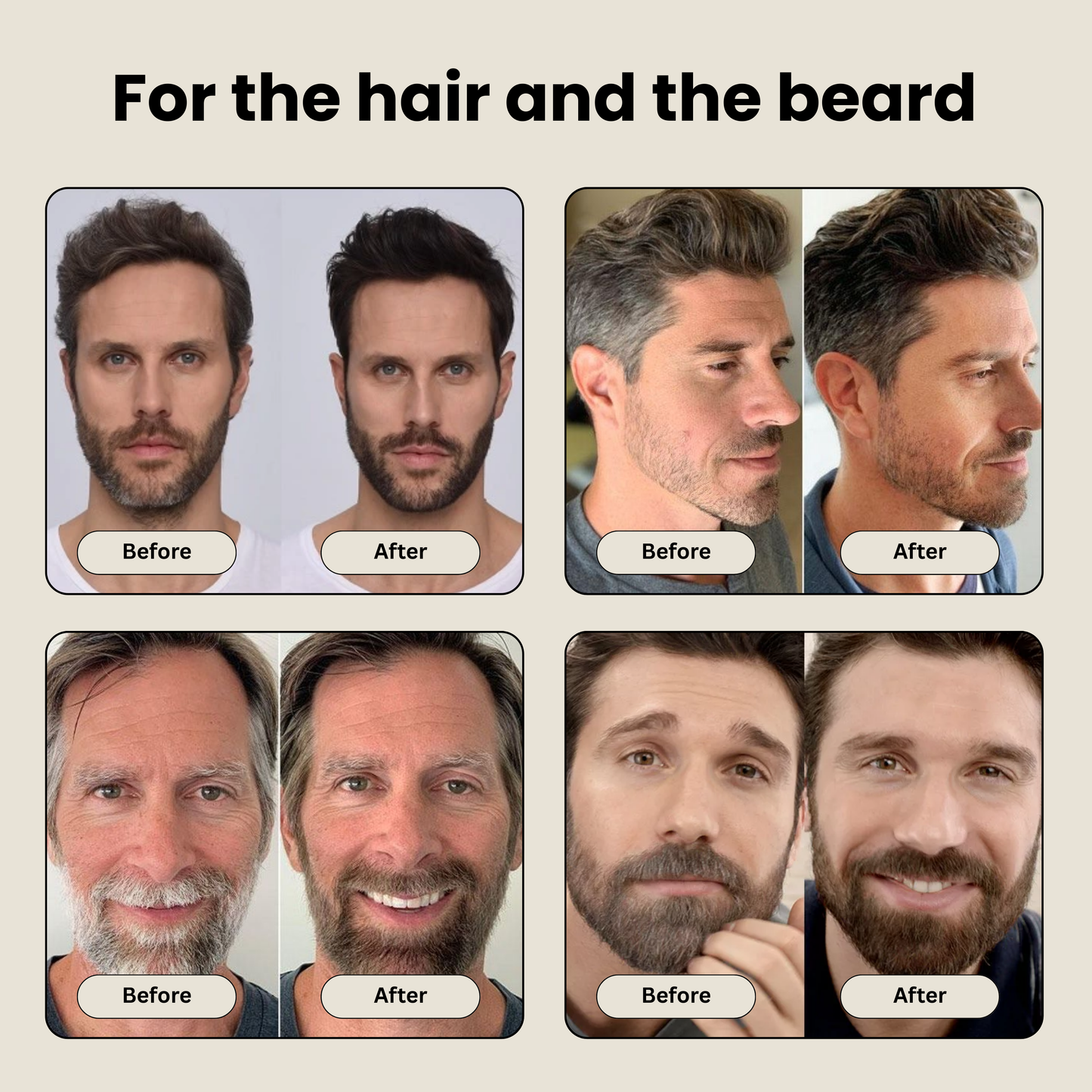 The Gray Remover™ - Hair Dye for Men